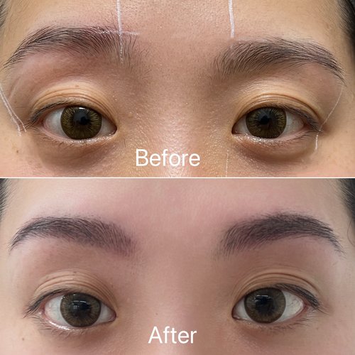 Brow before and after